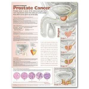 Understanding Prostate Cancer Chart/Poster  Industrial 