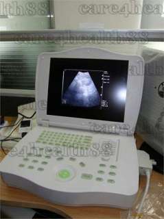 Portable Ultrasound Scanner machine w convex+ linear  