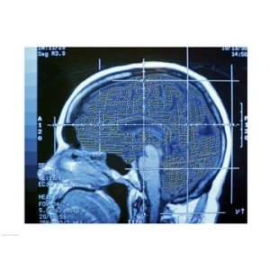  Close up of an MRI scan of the human brain Poster (24.00 x 