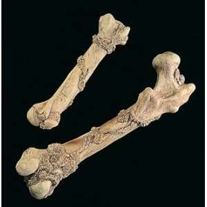 Humerus Bone Prop