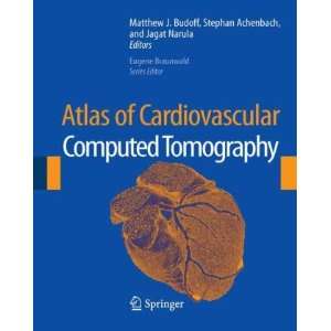 Atlas of Cardiovascular Computed Tomography includes narrated videos 