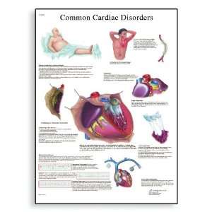   Cardiac Disorders Anatomical Chart, Poster Size 20 Width x 26 Height